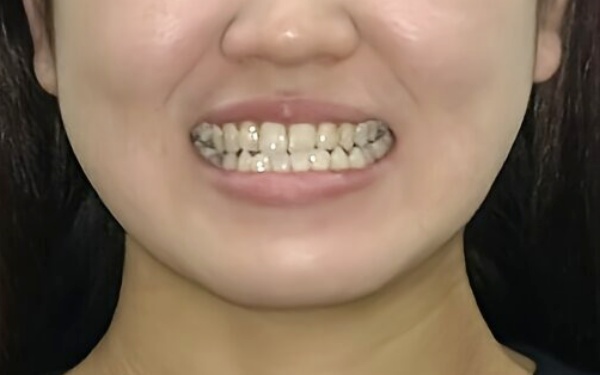 治療前画像