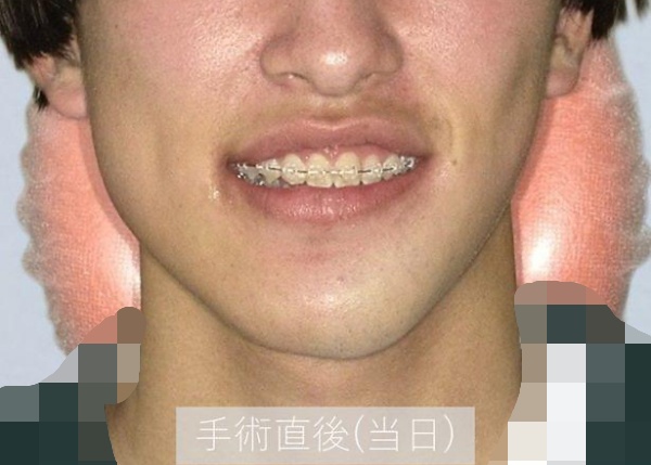 治療中画像